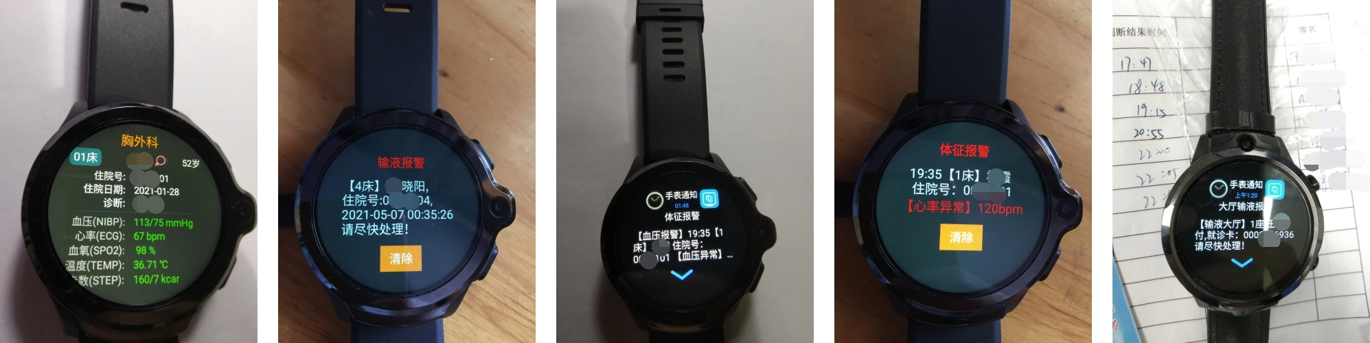 护士端智能手表-输液进度与体征报警提醒